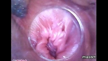 Licky Lex, Silvia Dellai-RAW Endoscopic Video-2017-01-26l 1