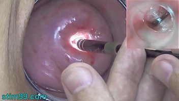 Endoscopic Camera in Cervix watch inside my Womb and Vagina. Inspection testing exam of wife by extreme doctor gynecologist